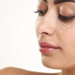 Achieve a Youthful Glow with Endolift Laser Under Eyes